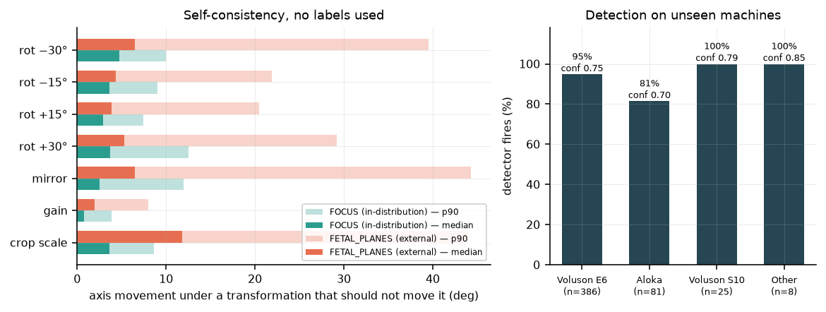 Error distribution on external data compared with the in-distribution test split