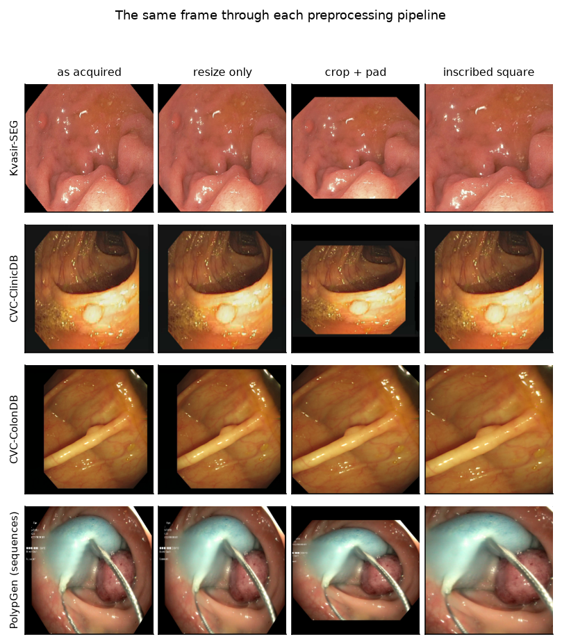 The same endoscopic frame shown through each preprocessing pipeline: as acquired, resized, cropped to the field of view and padded, and reduced to the inscribed square